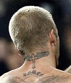 David Beckham hair transplant scar