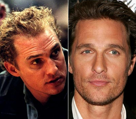 matthew mcconaughey hair transplant