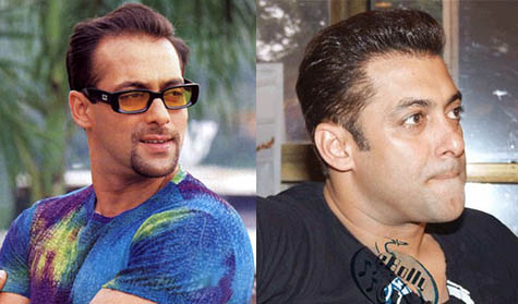 Salman Khan hair transplant