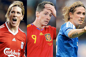 footballers hair transplants