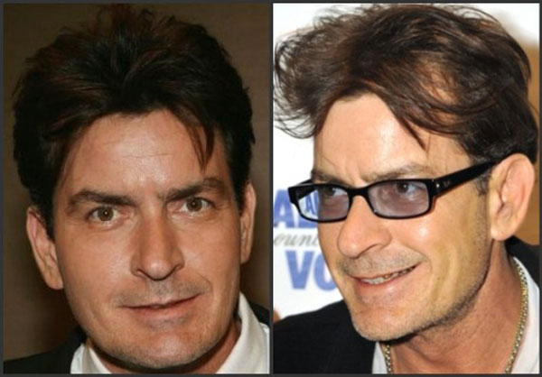 Is Charlie Sheen going bald?
