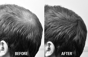 nanogen hair thickening fibres before and after