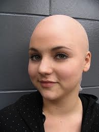 bald lady