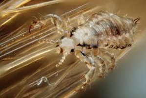 Dubai denies claims head lice are used as hair loss treatment