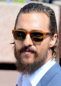 Does Matthew McConaughey suffer from hair loss?