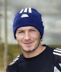 Is David Beckham losing his hair?
