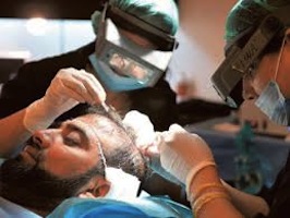 What's it really like to have a hair transplant?