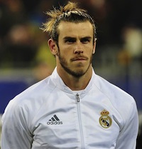 Will Gareth Bale be the next footballer to have a hair transplant?